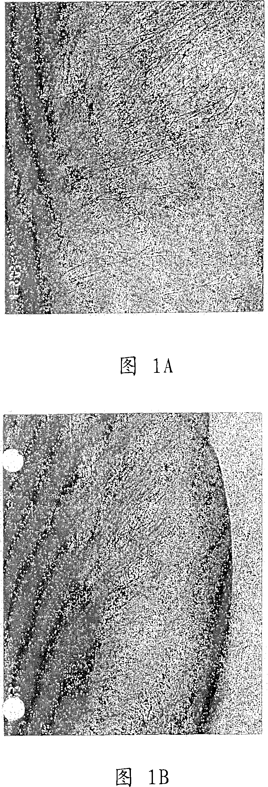 Method of treating granuloma annulare or sarcoid