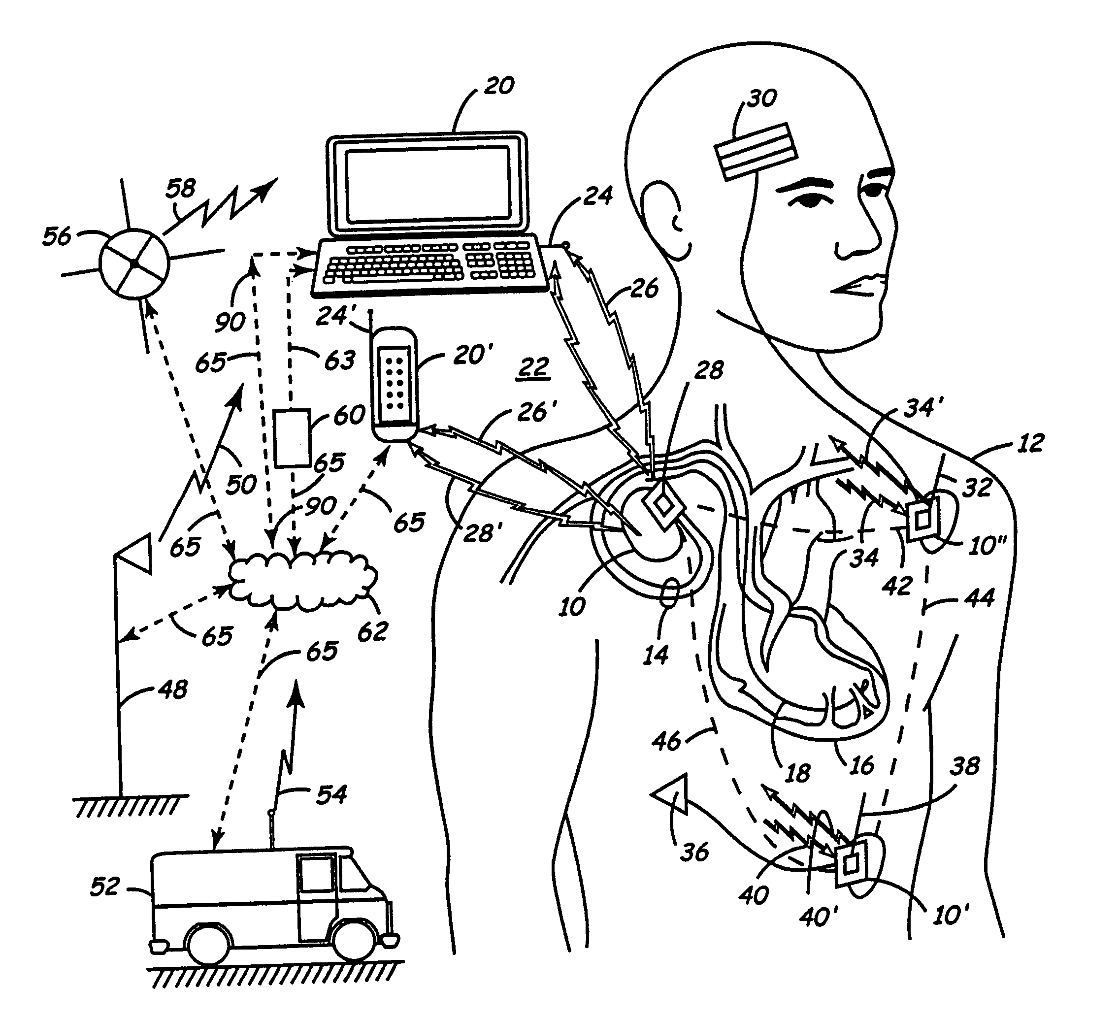 Communications system for an implantable medical device and a delivery device
