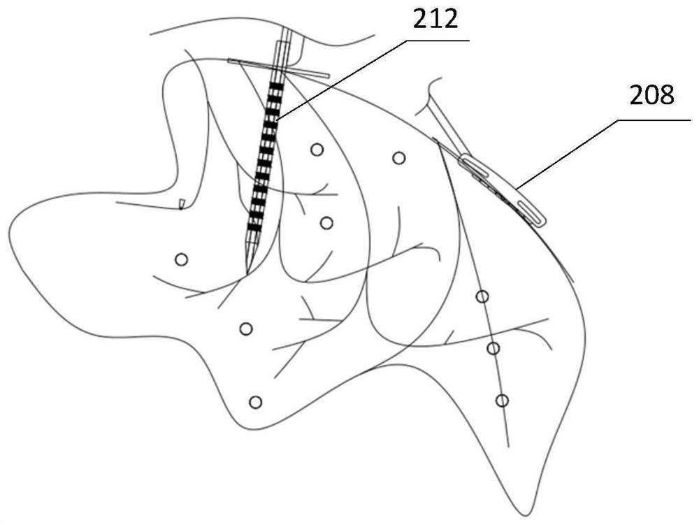 Artificial auditory midbrain stimulator