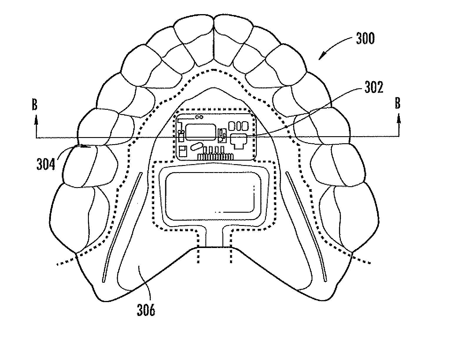 Electronic snore recording device and associated methods