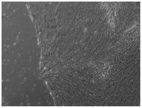 Method for promoting directional differentiation of umbilical cord mesenchymal stem cells into chondrogenesis