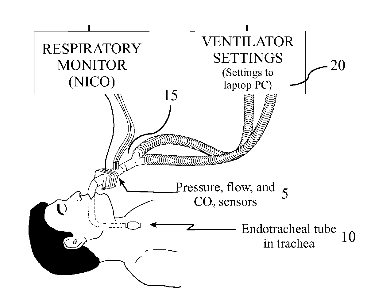 System and Method for Assessing Real Time Pulmonary Mechanics