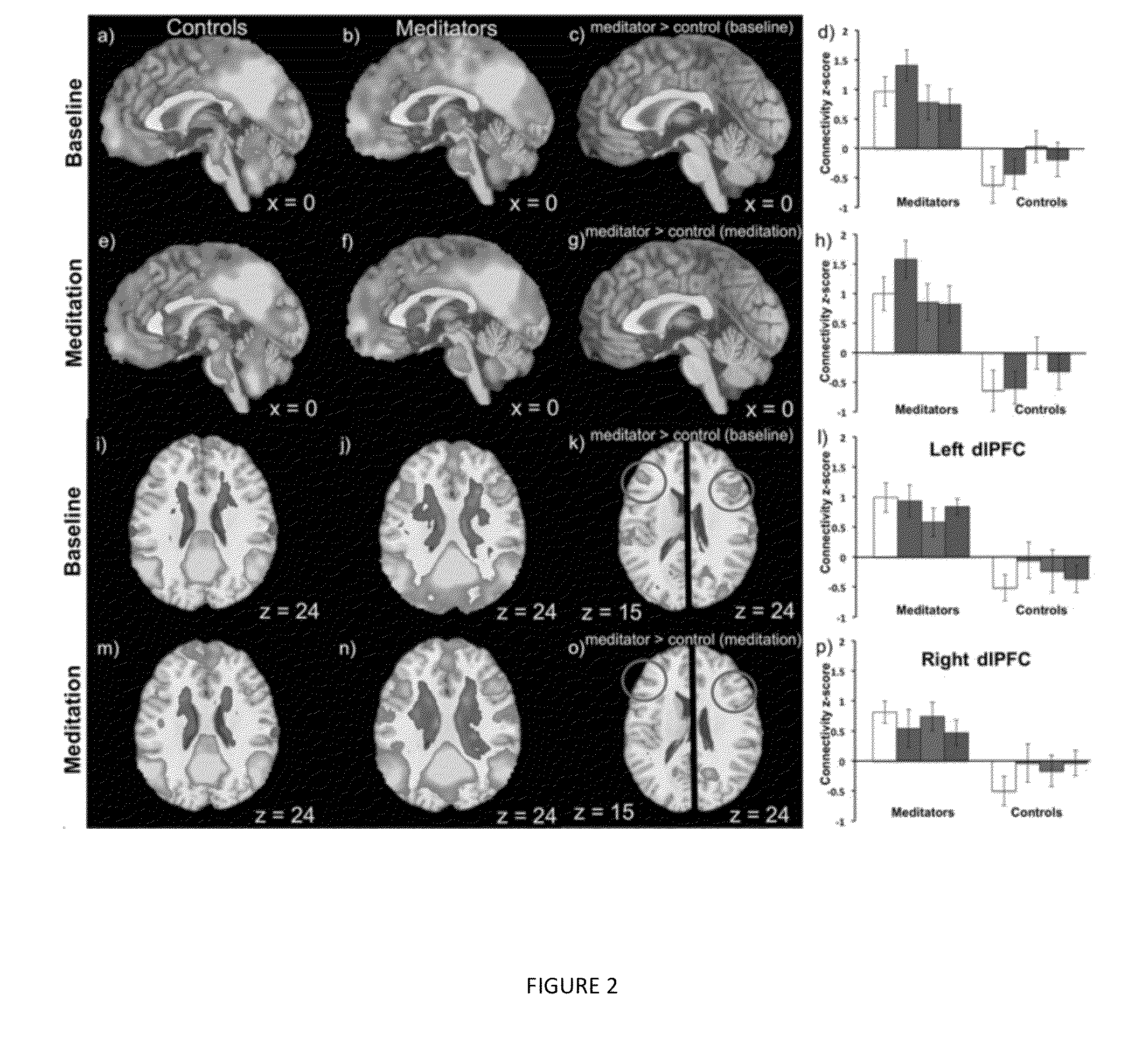 System and Method for Regulating Brain Activity