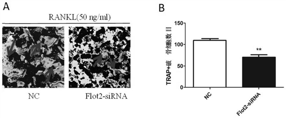 Use of flot2 inhibitors to inhibit osteoclastogenesis and/or osteoclastic activity