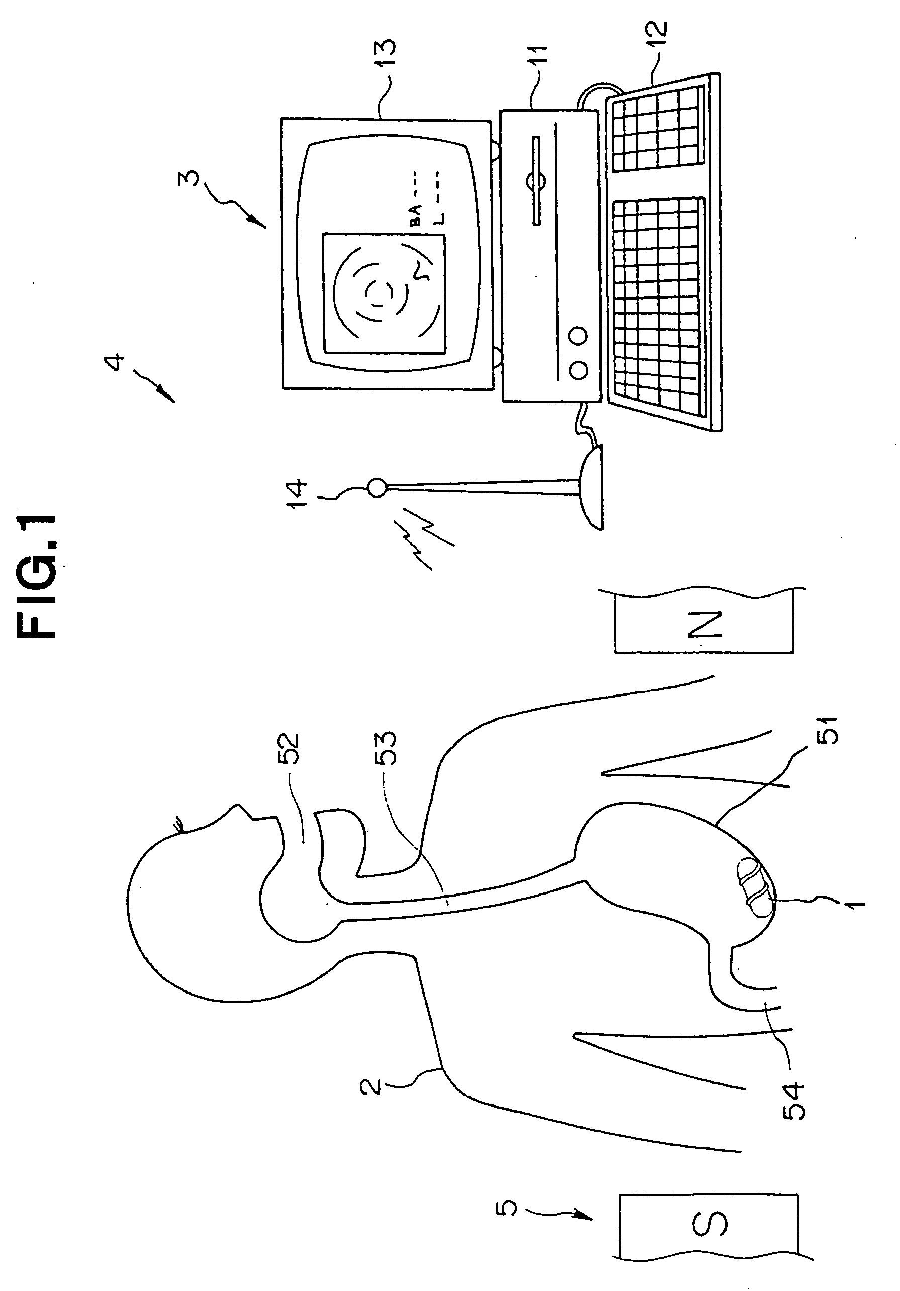Medical device