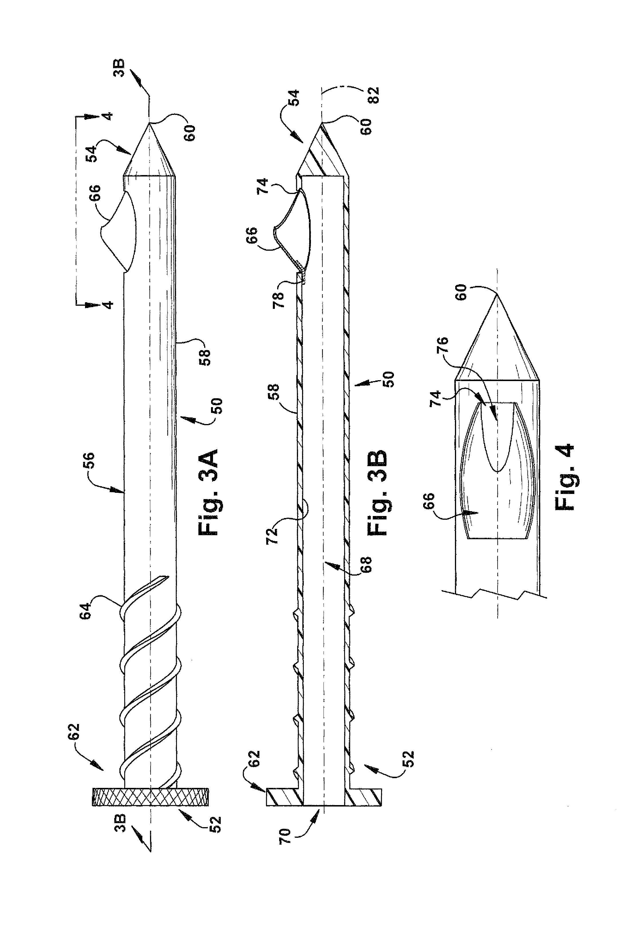Method and apparatus for tissue sampling