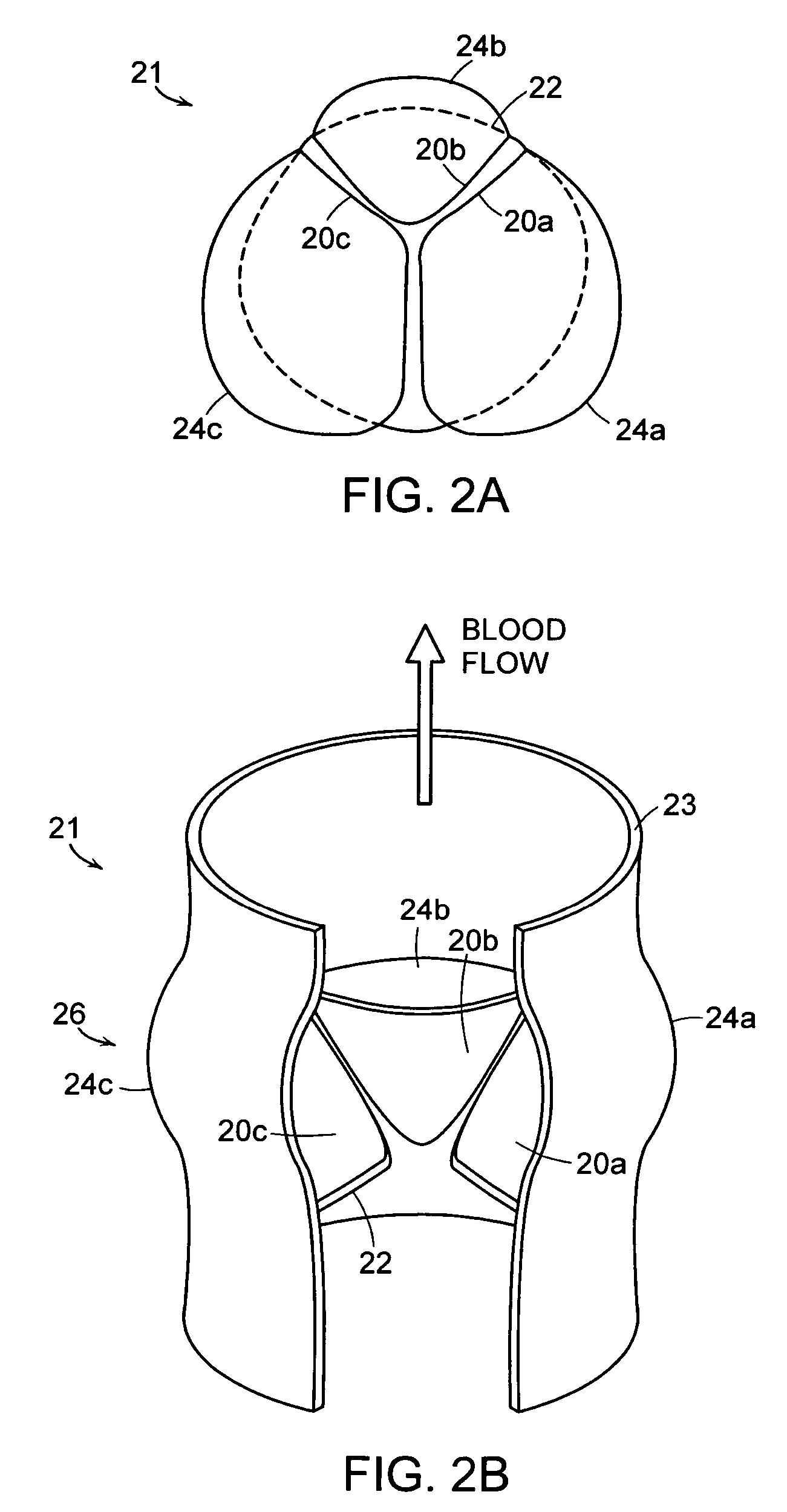Transcatheter delivery of a replacement heart valve