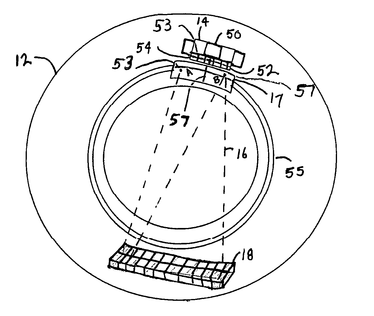 Integrated arc anode x-ray source for a computed tomography system