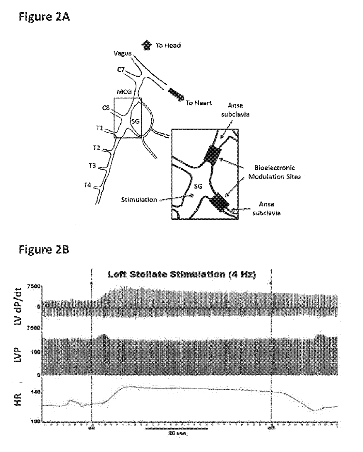 Treatment of cardiac dysfunction