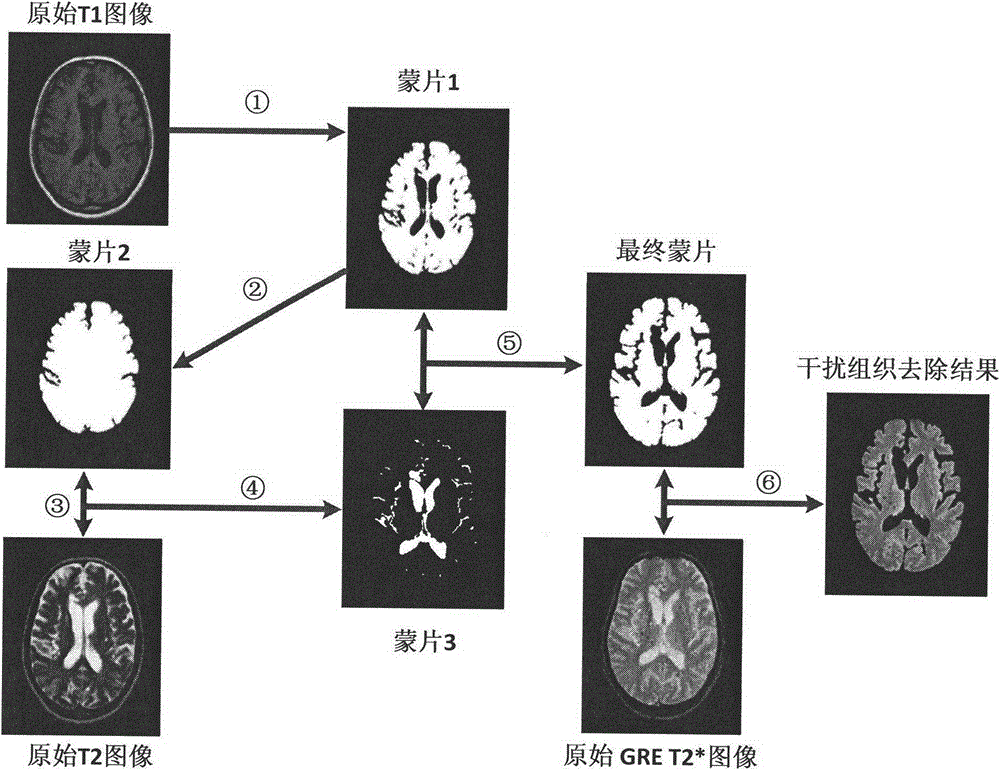 Magnetic resonance image based cerebral micro-bleeding computer auxiliary detection system