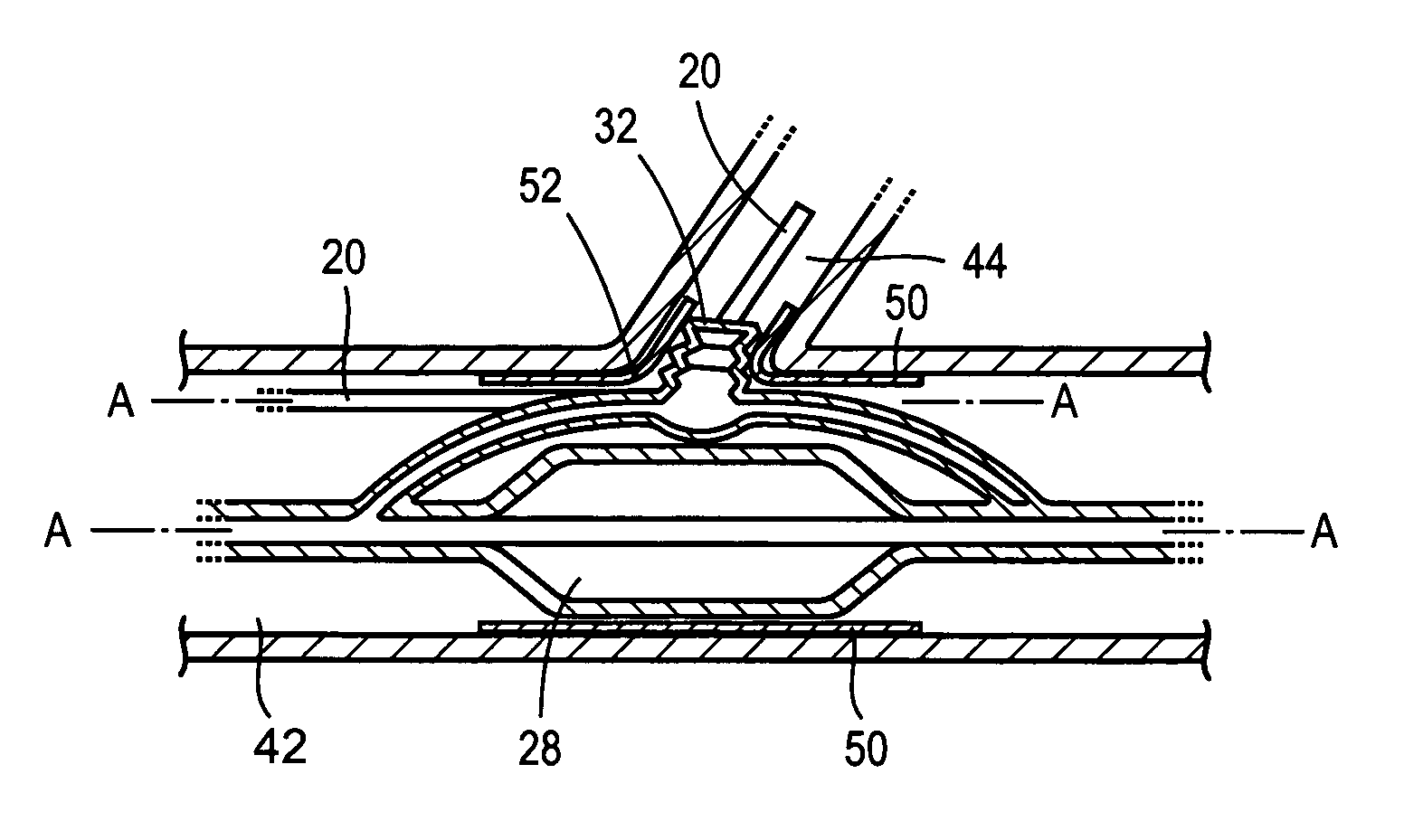 Catheter balloon systems and methods