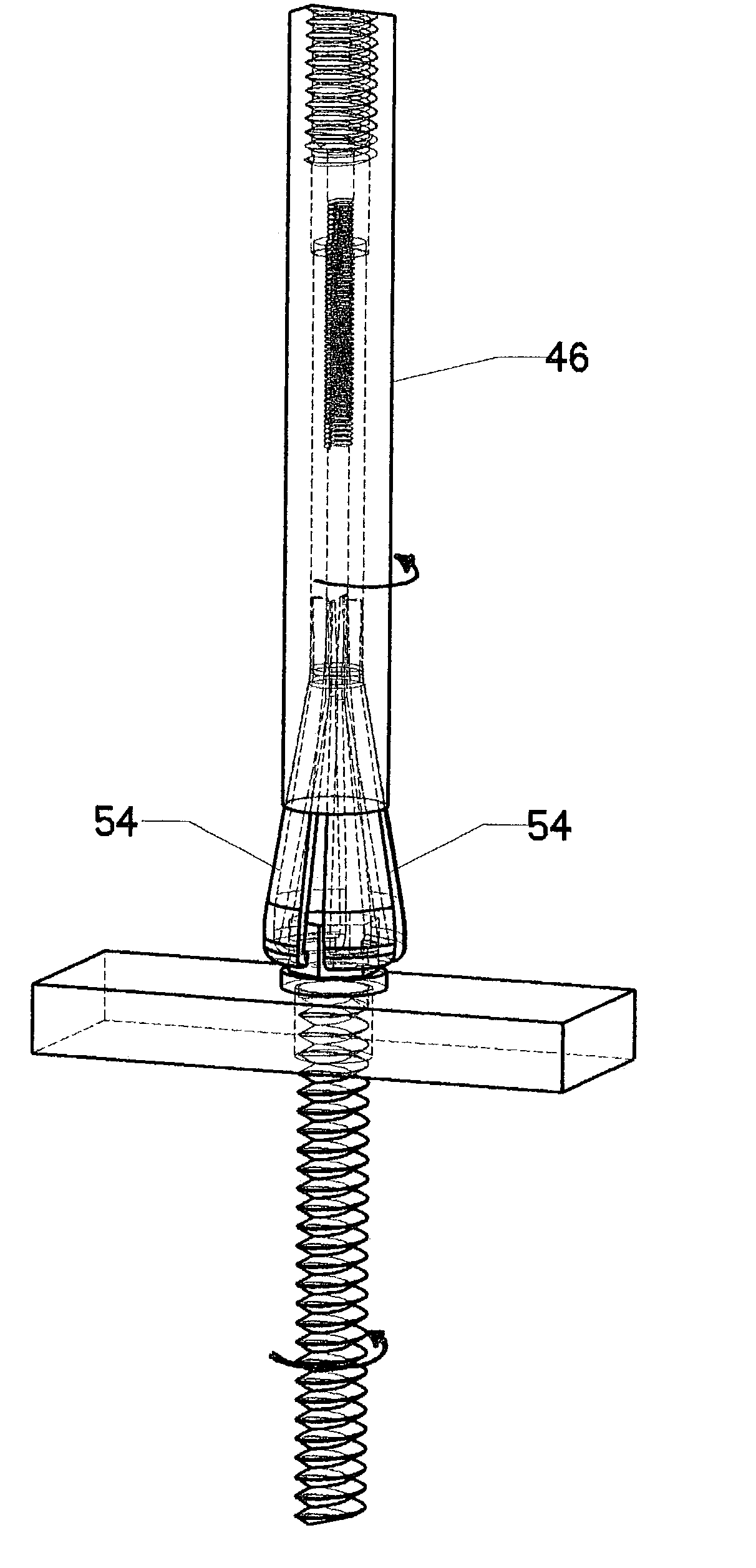 Method for removing orthopaedic hardware