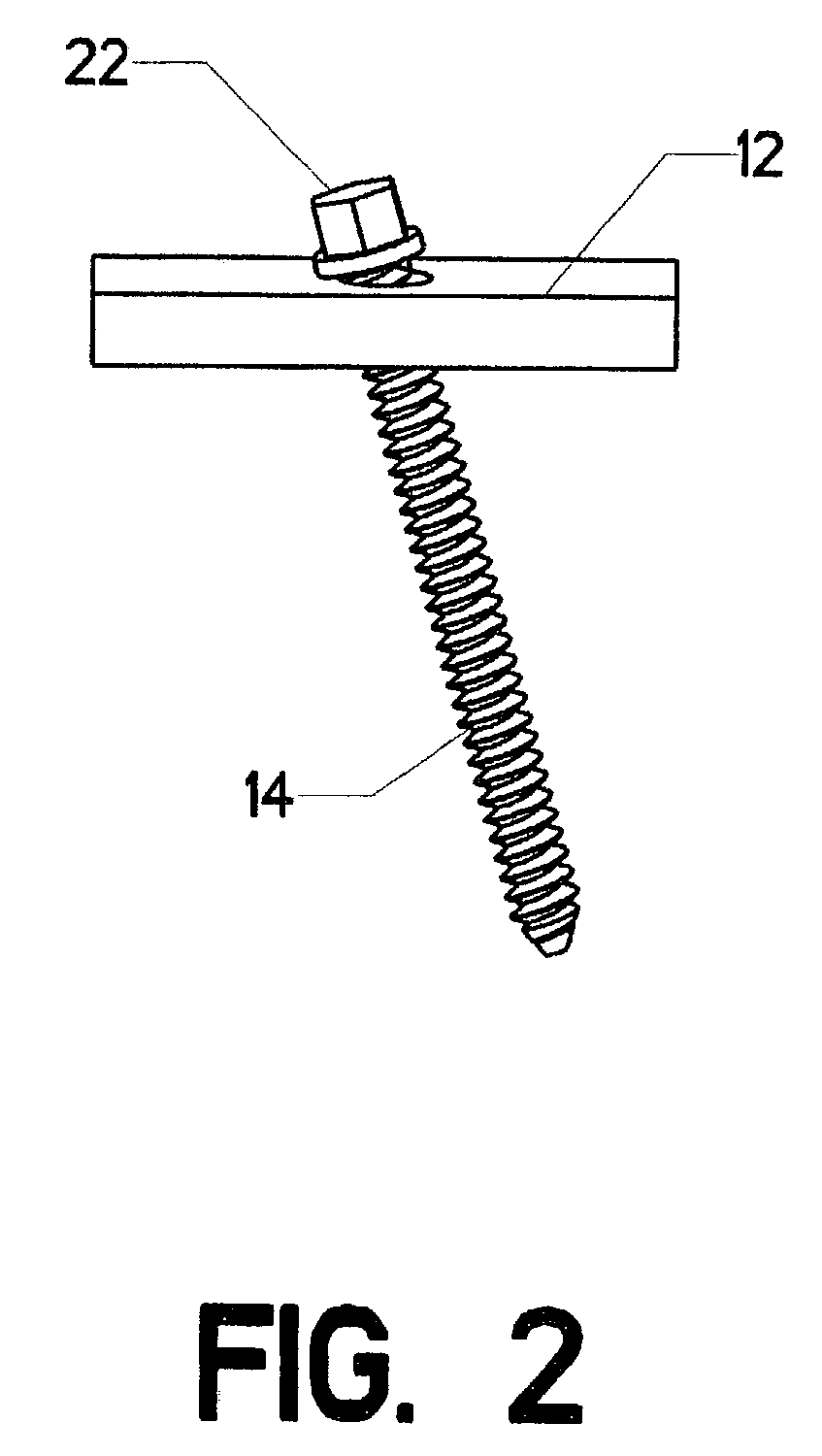 Method for removing orthopaedic hardware