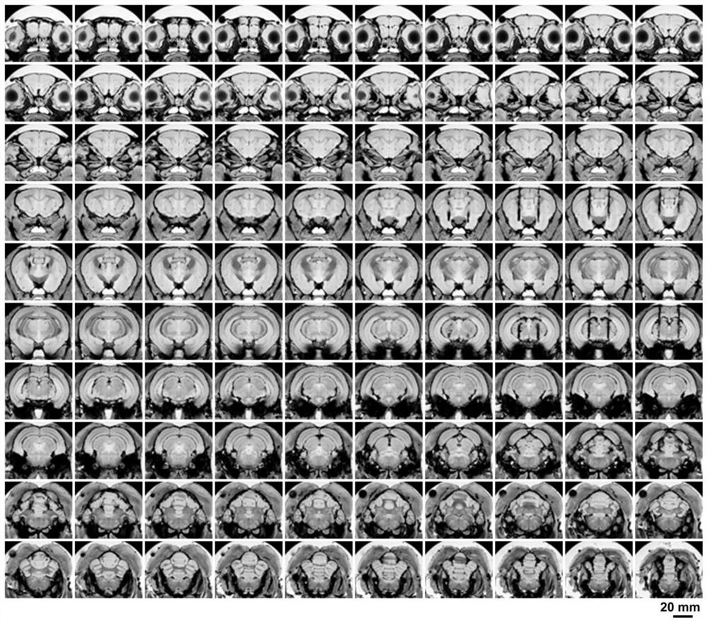 Tree shrew brain nucleus positioning method