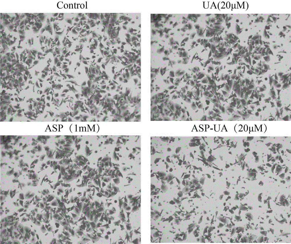 Ursolic acid-aspirin conjugate and application thereof in preparing drugs for preventing tumor metastasis