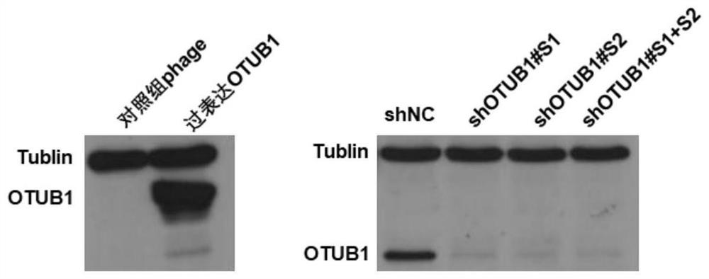 Application of ubiquitin aldehyde-binding protein 1 containing otu functional domain in the preparation of drugs for treating fatty liver and related diseases