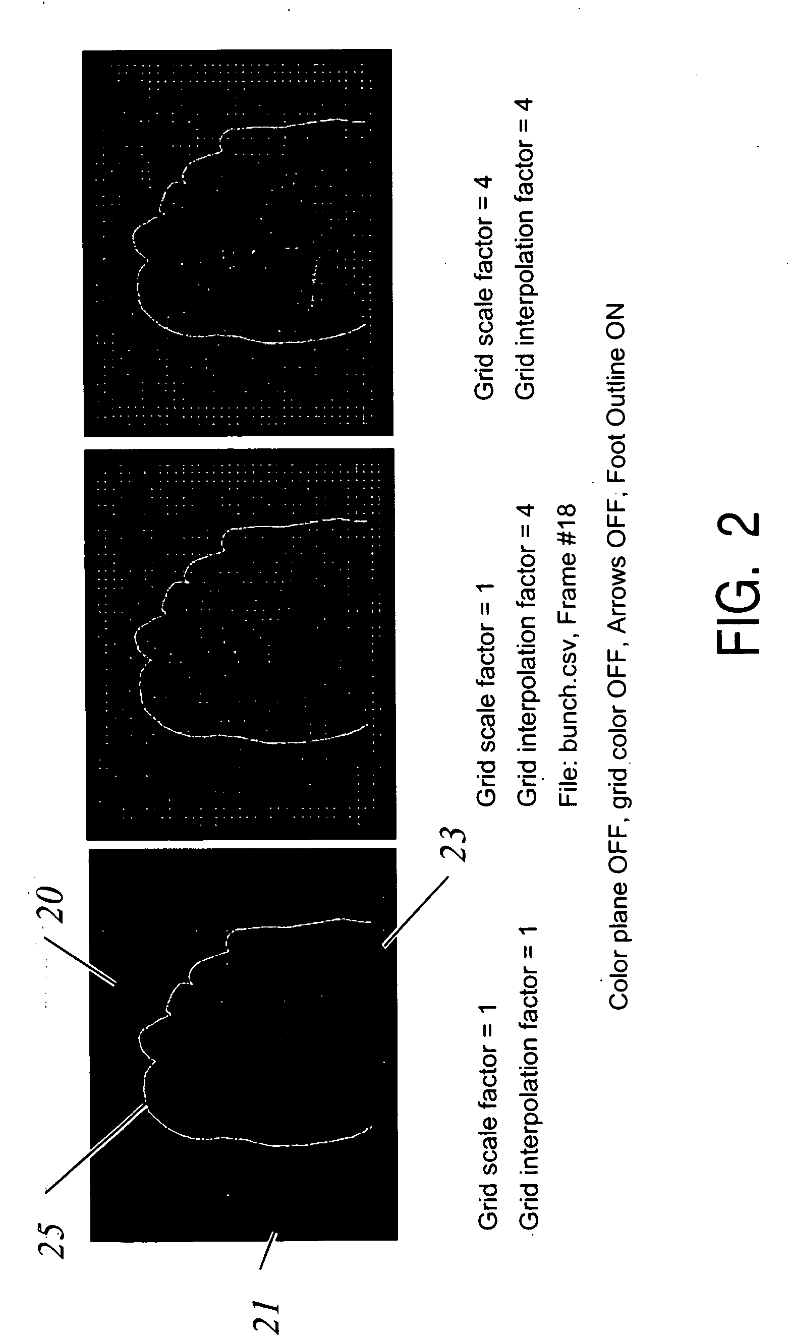 Foot pressure and shear data visualization system