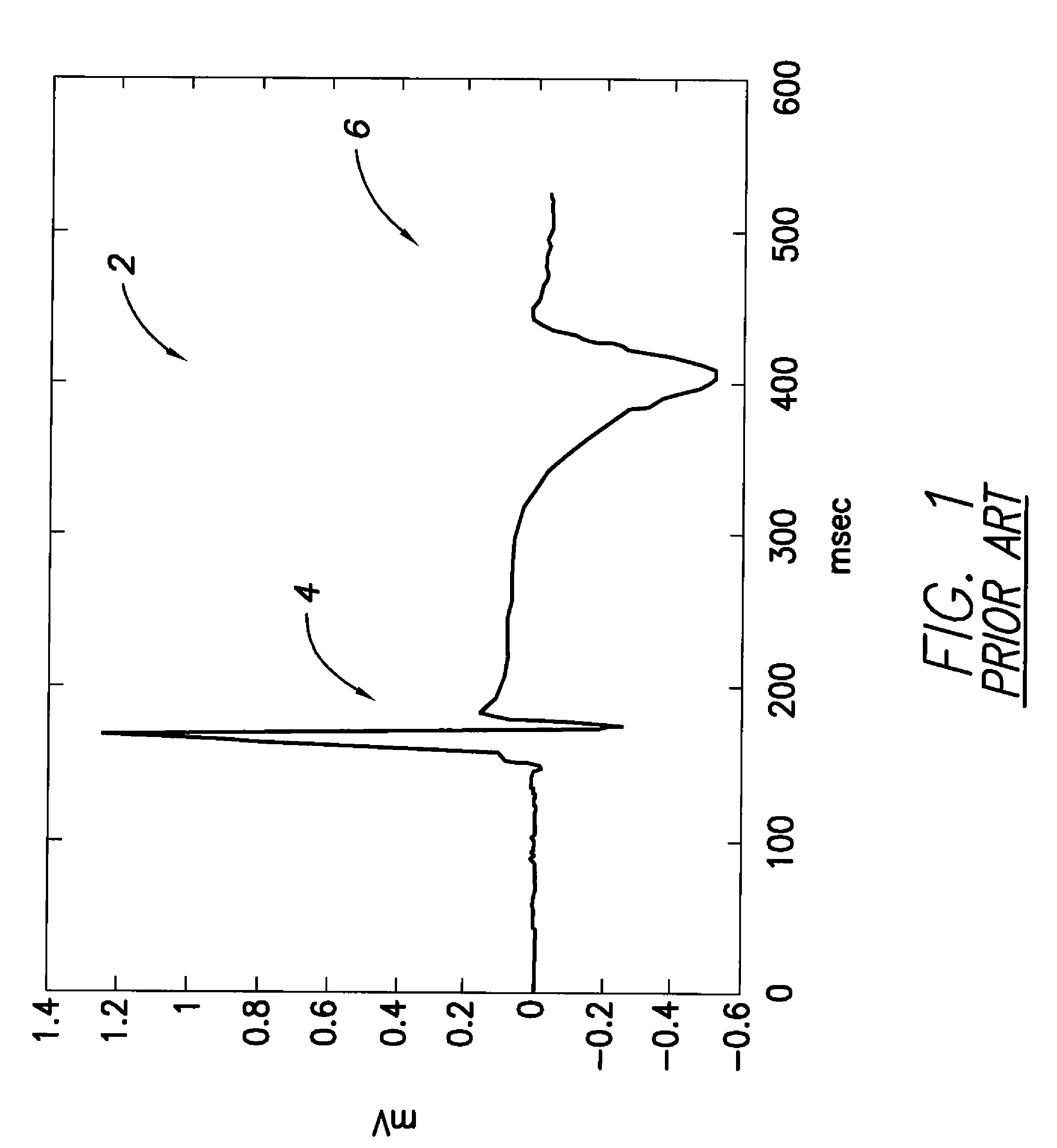 Systems and methods for employing an FFT to distinguish R-waves from T-waves using an implantable medical device
