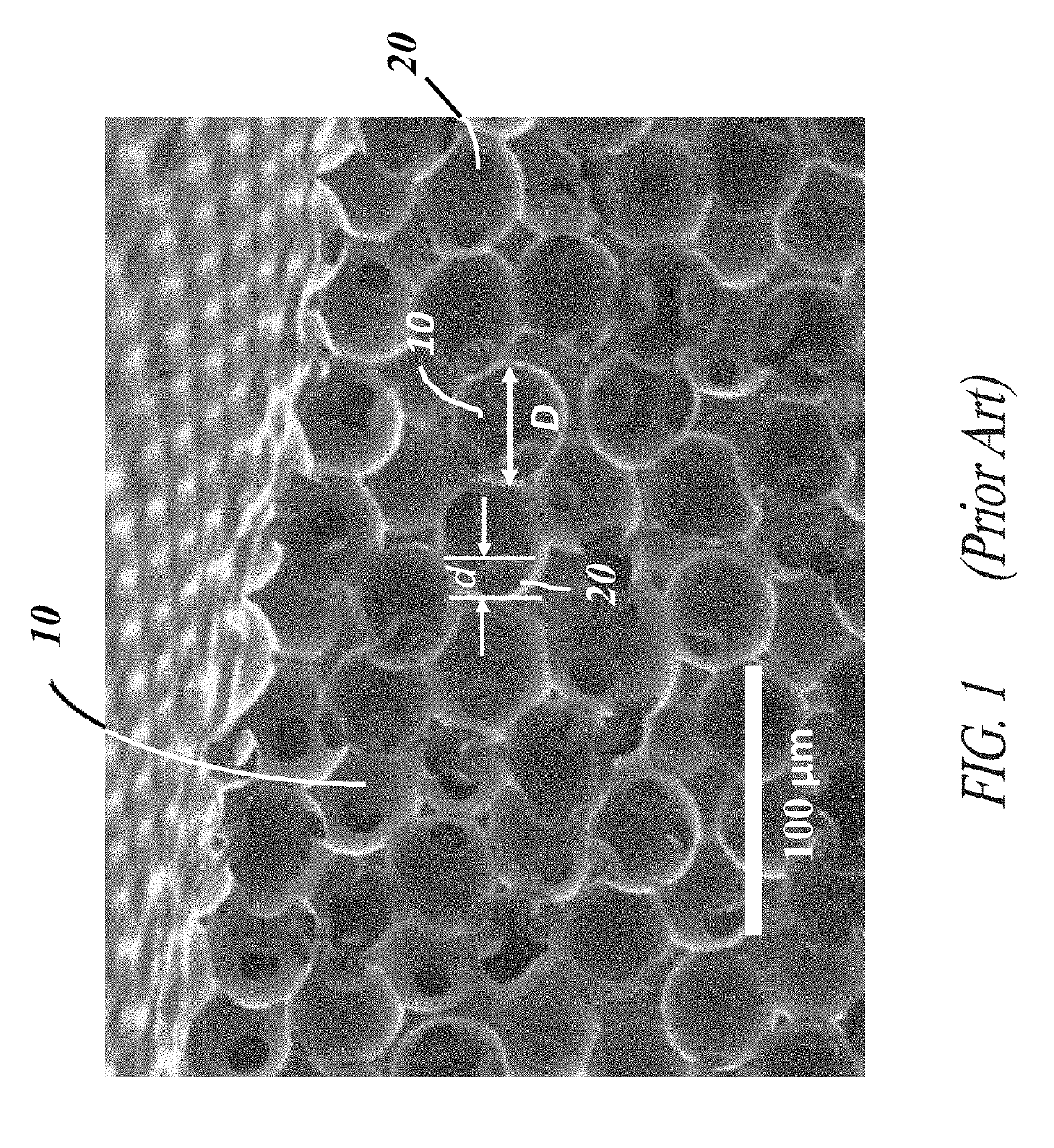 Corrugated microporous tissue interface for improved performance and infection resistance of vascular grafts and other implantable devices