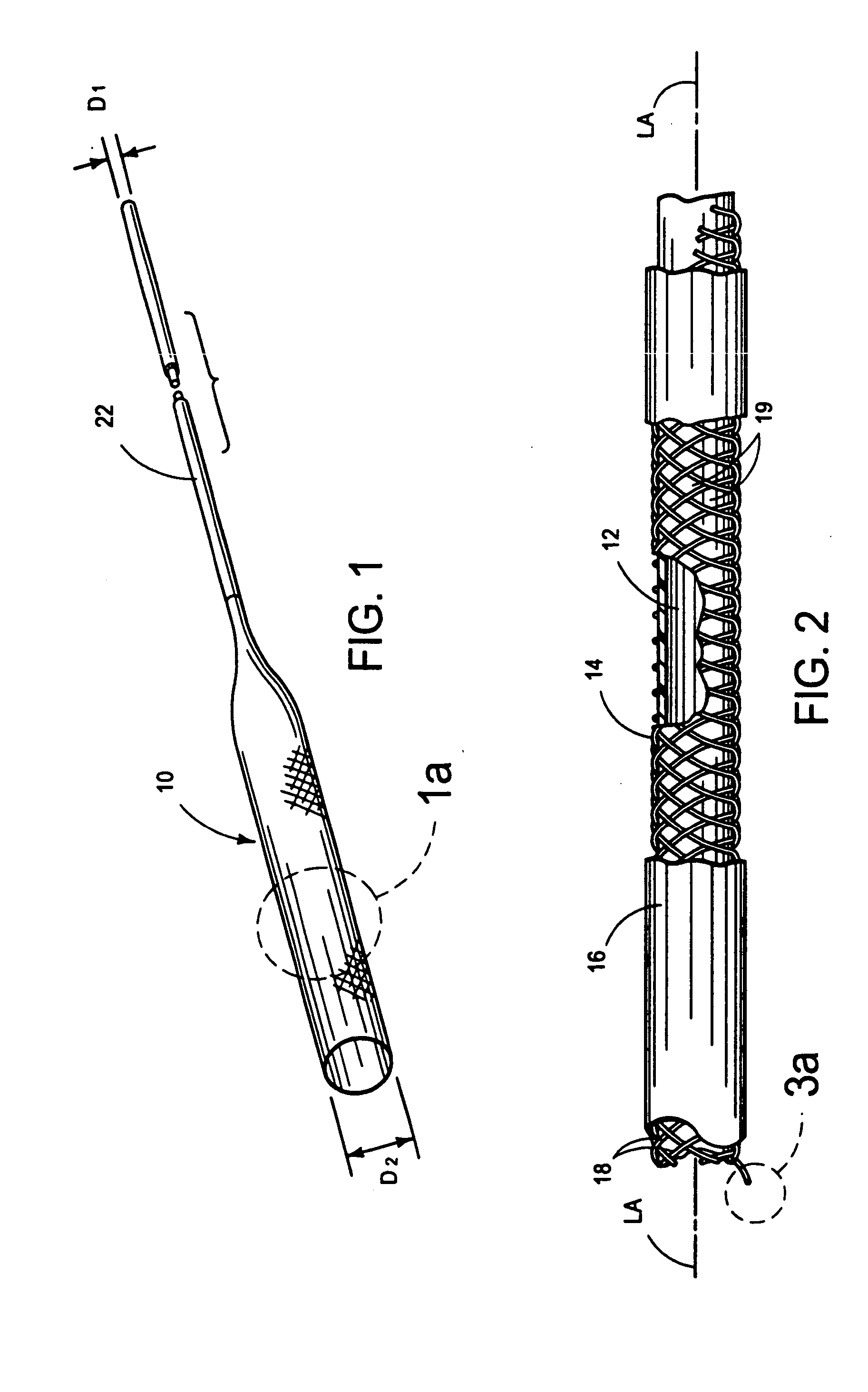 Polymer coated stents