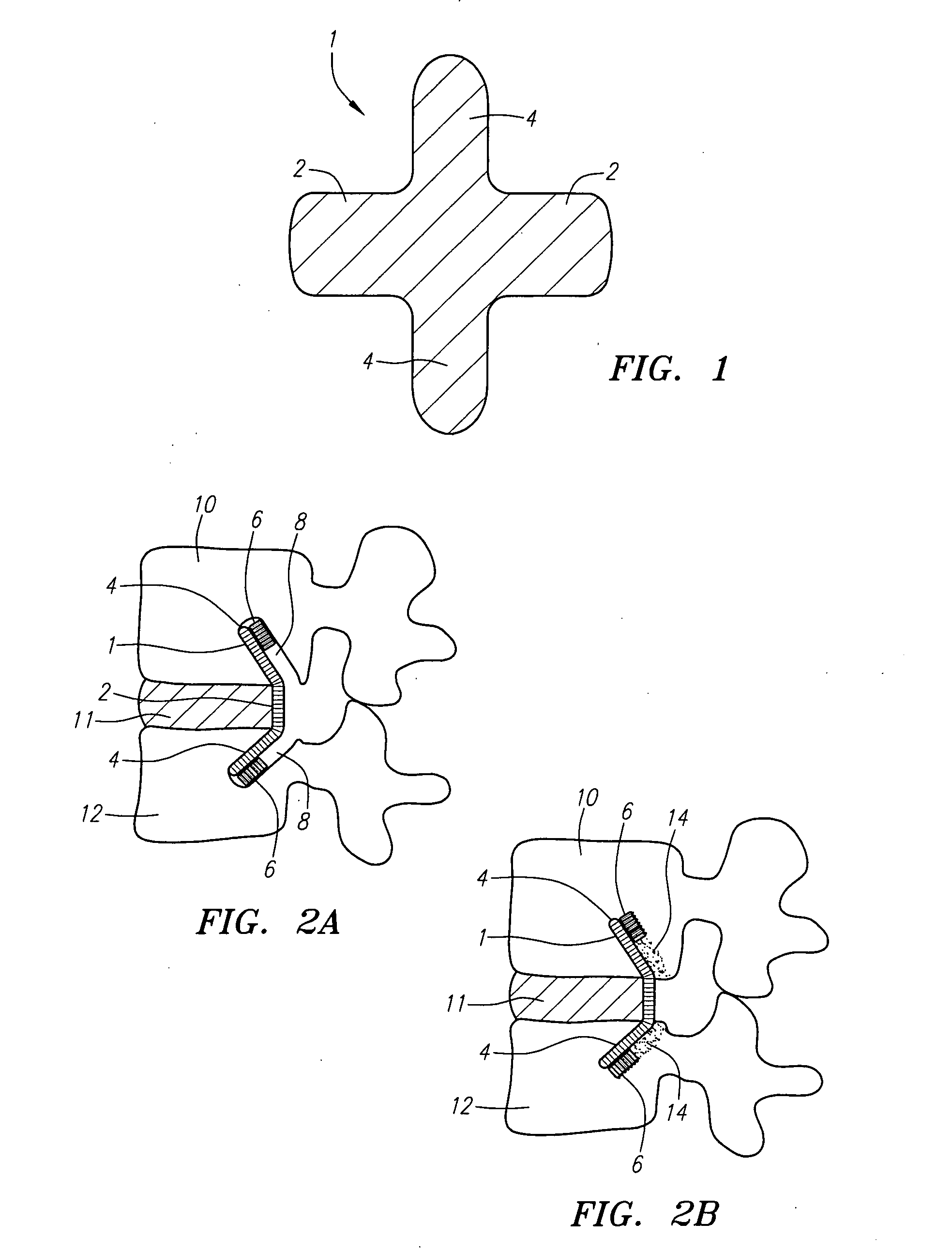 Methods and apparatus for reconstructing the annulus fibrosis