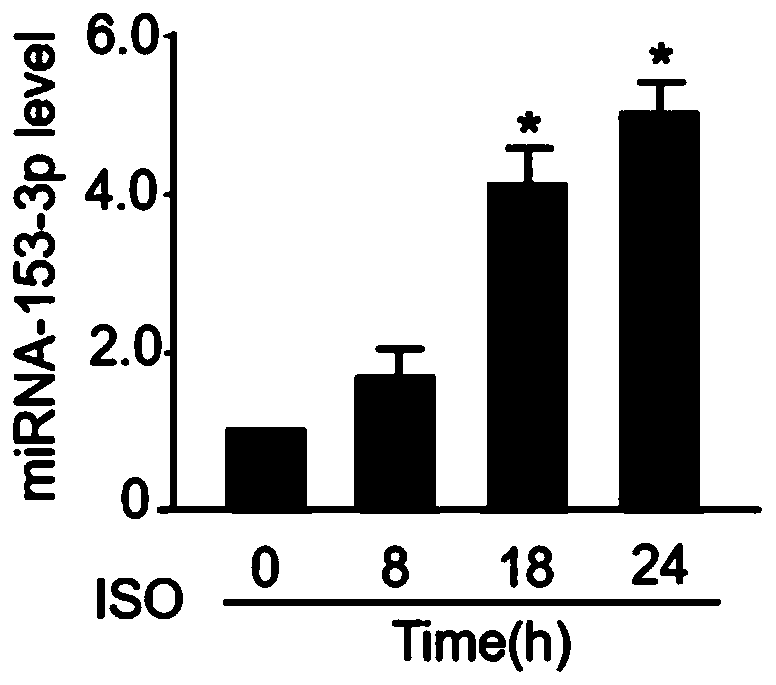 Application of miR-153-3p and interferent thereof and product