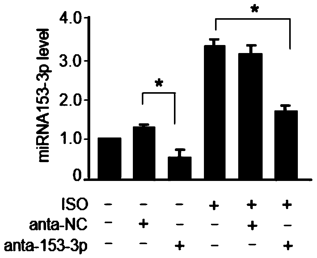 Application of miR-153-3p and interferent thereof and product