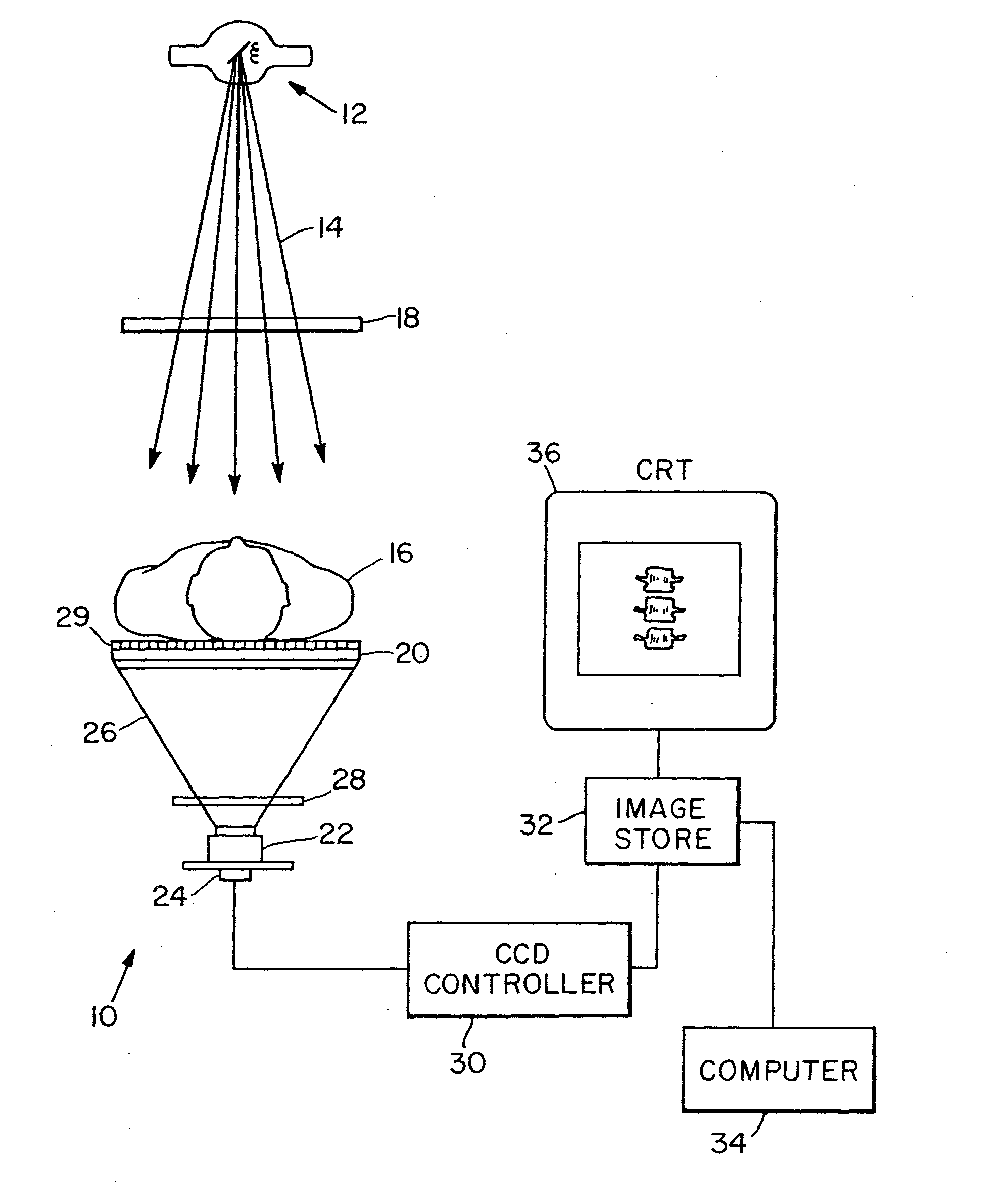 System for quantitative radiographic imaging