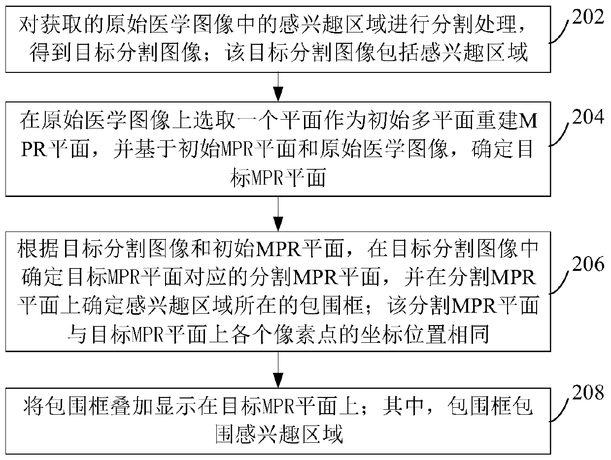 Region of interest display method and device, equipment and storage medium