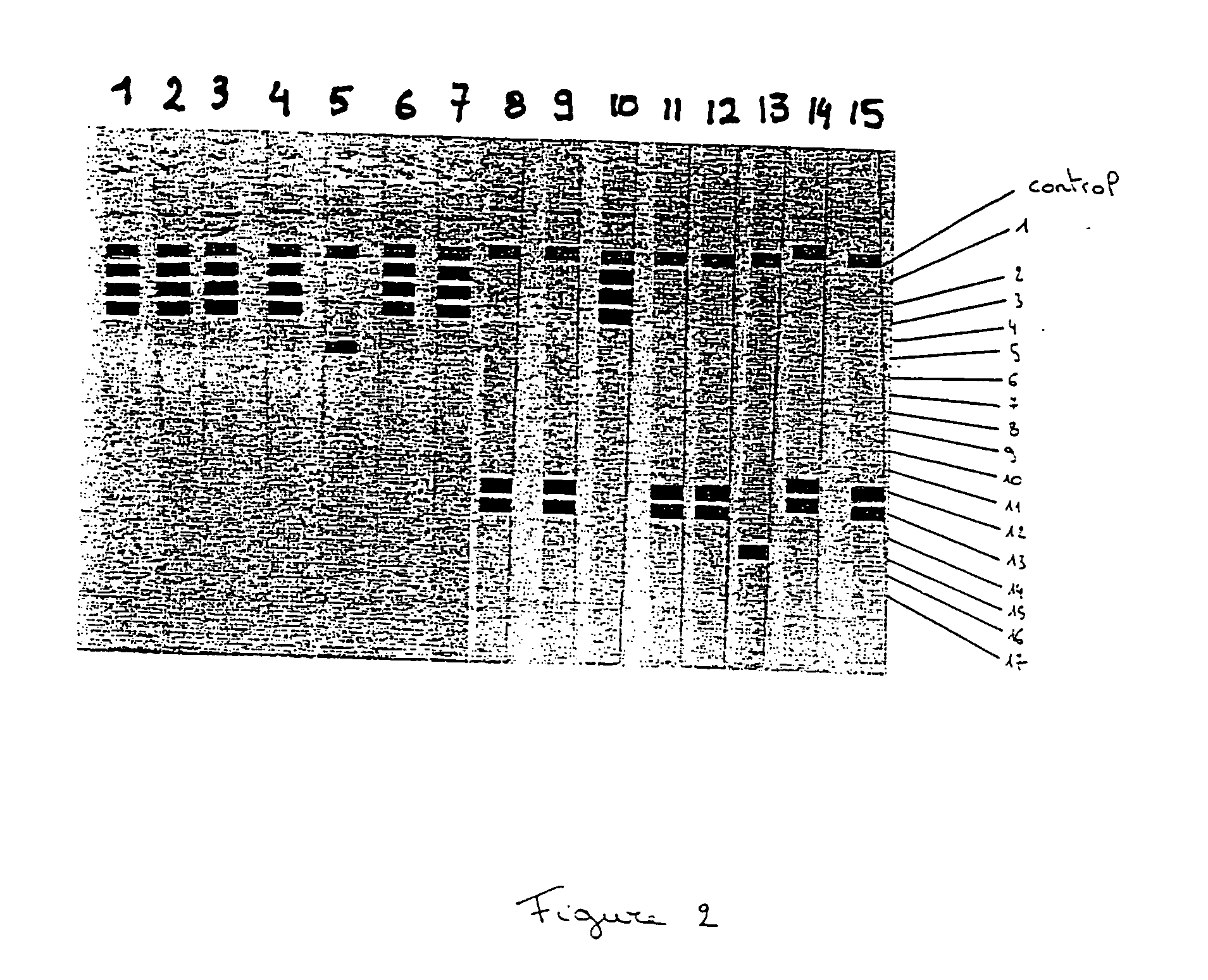 Nucleic acid probes and methods for detecting clinically important fungal pathogens