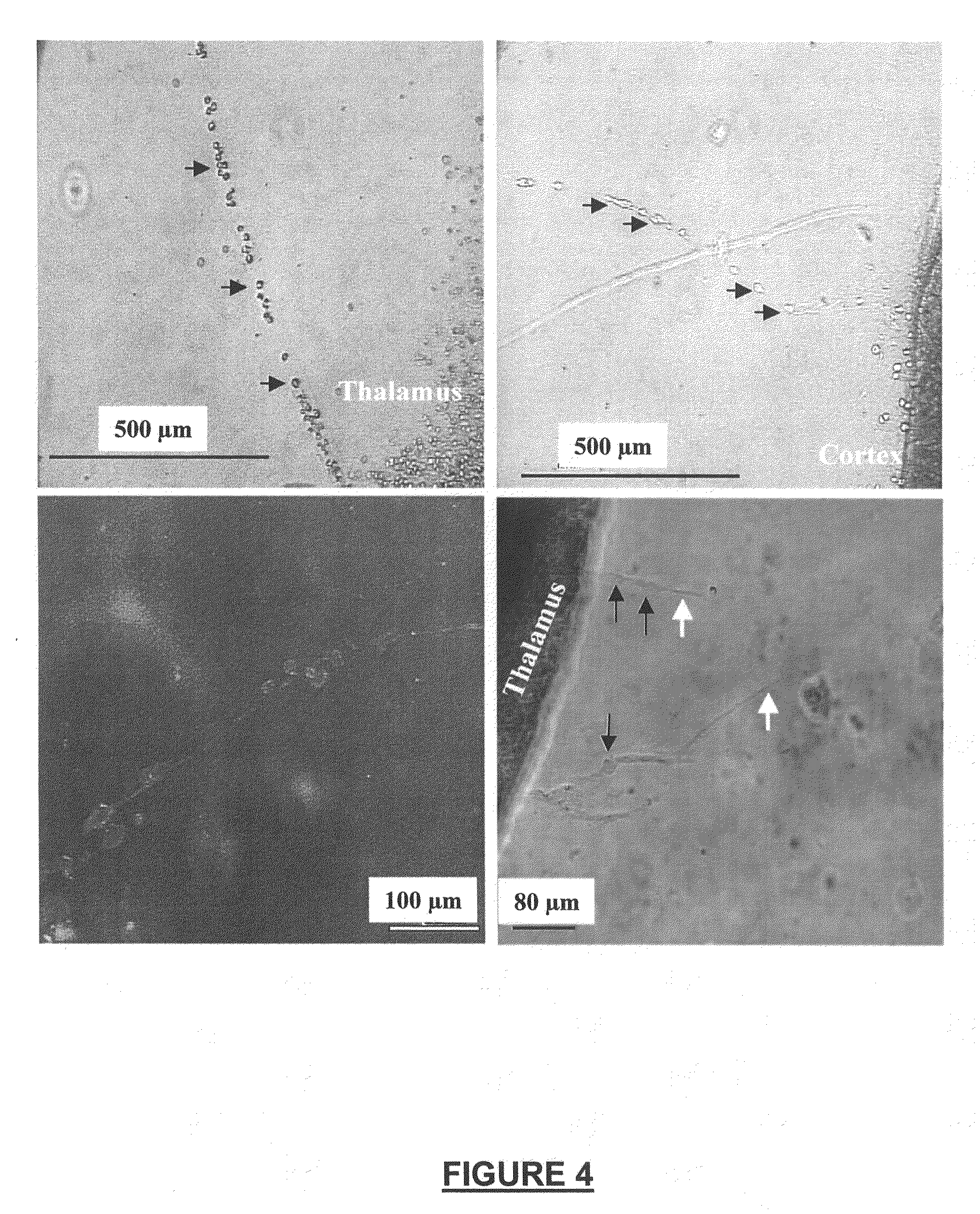 Neural regeneration peptides and methods for their use in treatment of neural injury or degeneration
