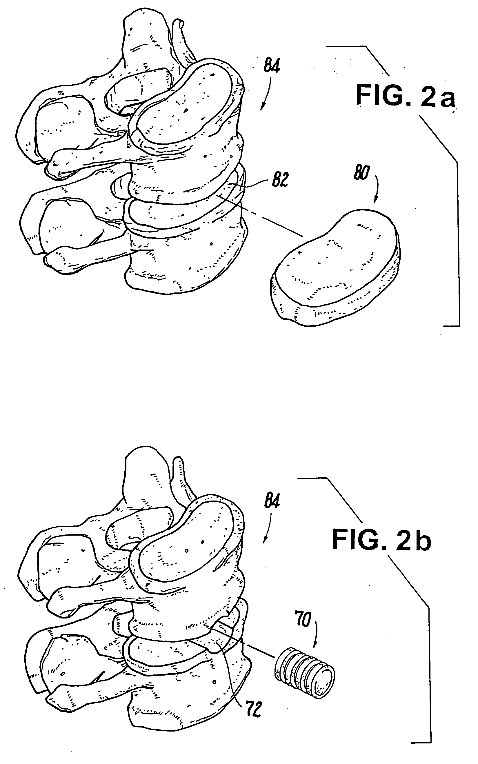 Shaped load-bearing osteoimplant and methods of making same