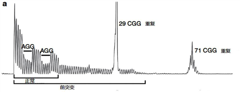 A kit for determining the number and position of agg insertions in the cgg repeat sequence of fmr1 gene and its application method