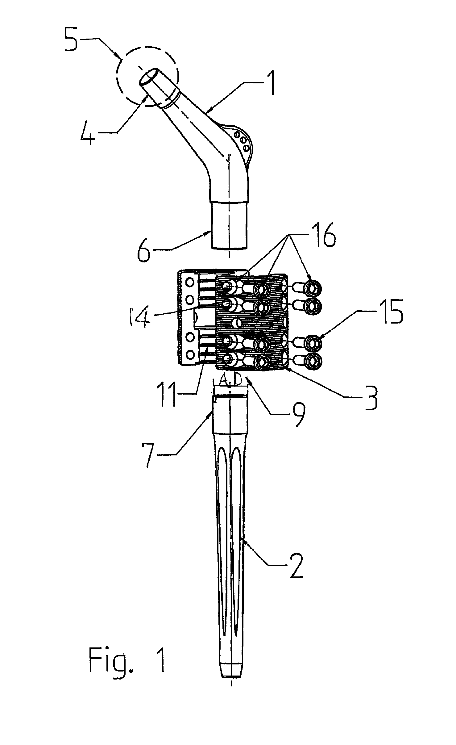 Modular joint prosthesis