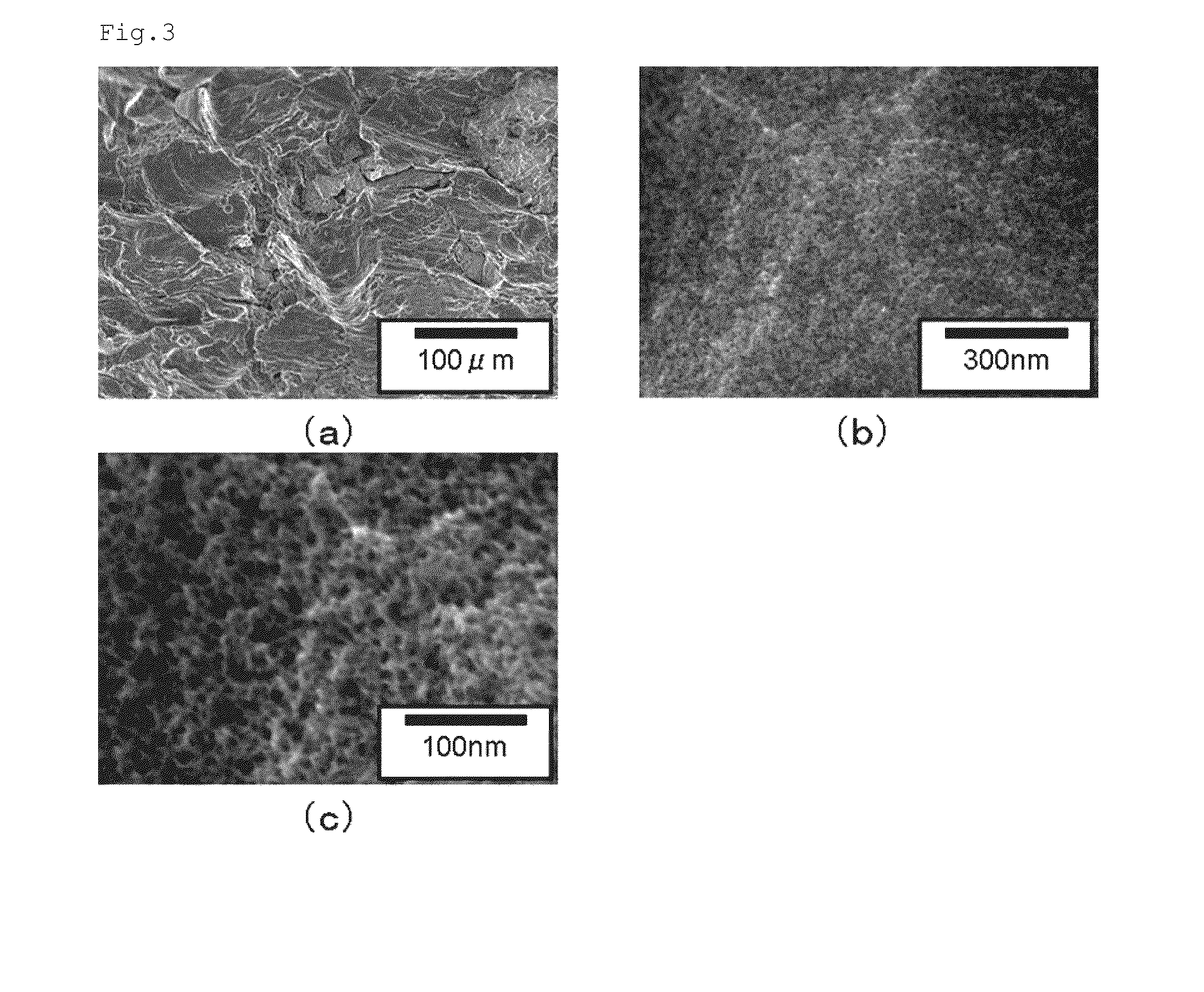 Metal/resin composite structure