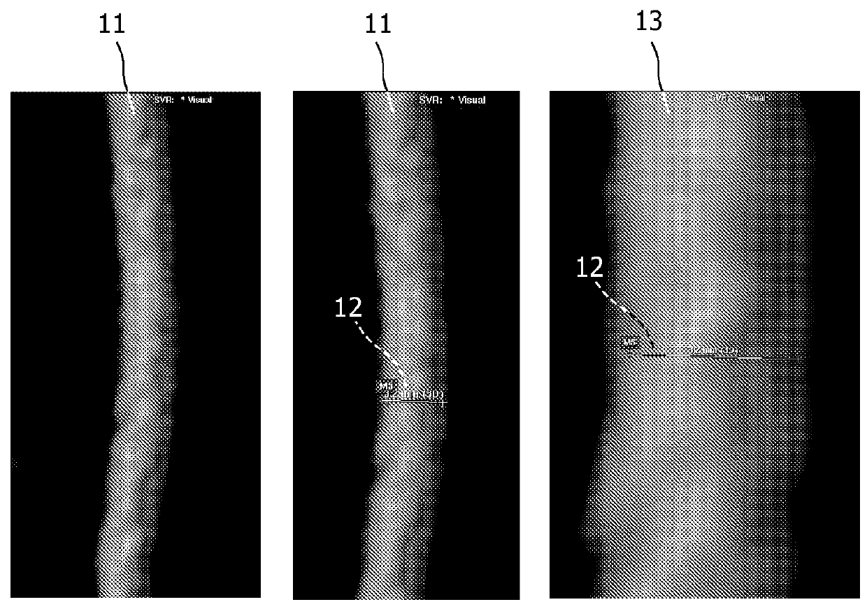 Caliper for measuring objects in an image