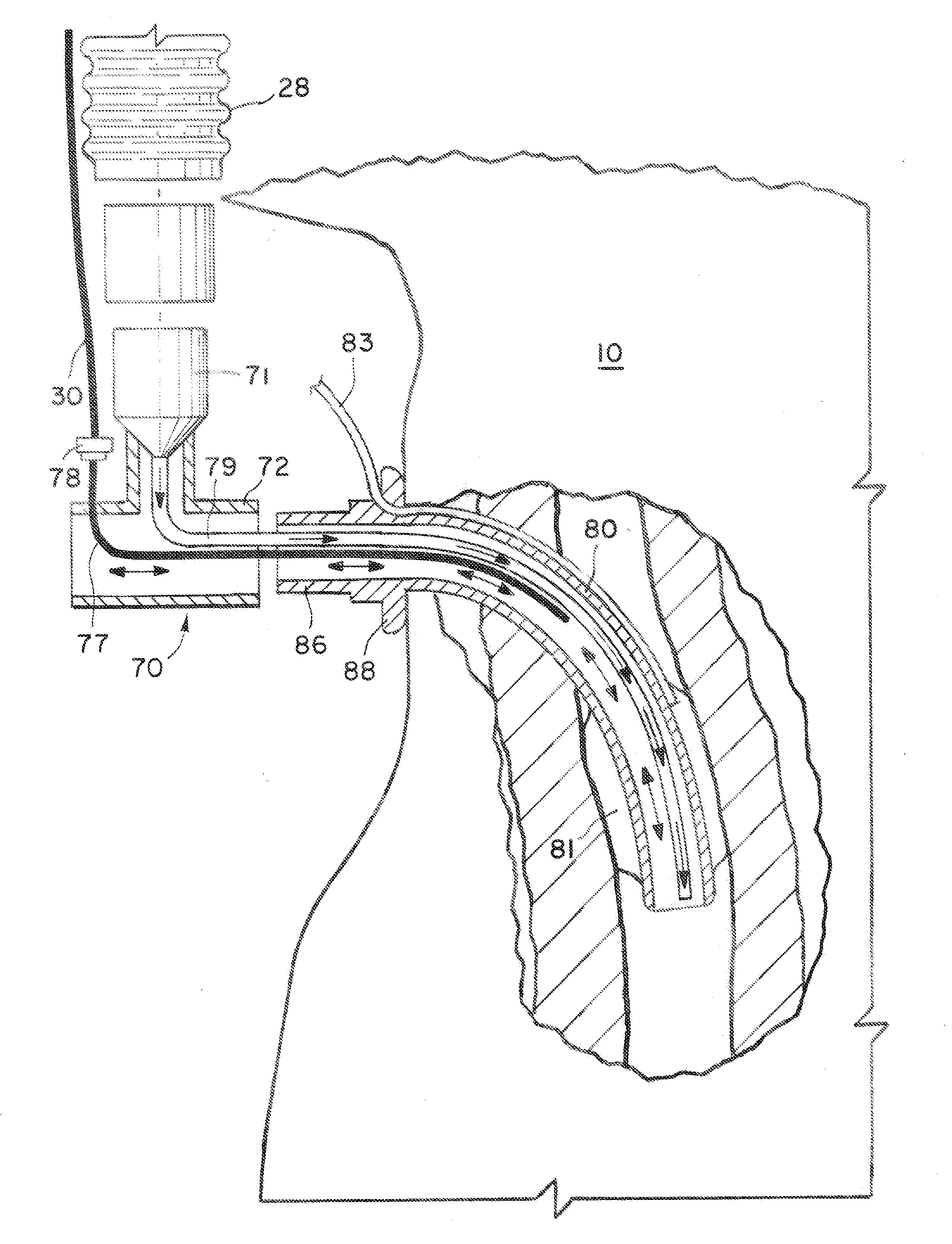 System for providing flow-targeted ventilation synchronized to a patient's breathing cycle