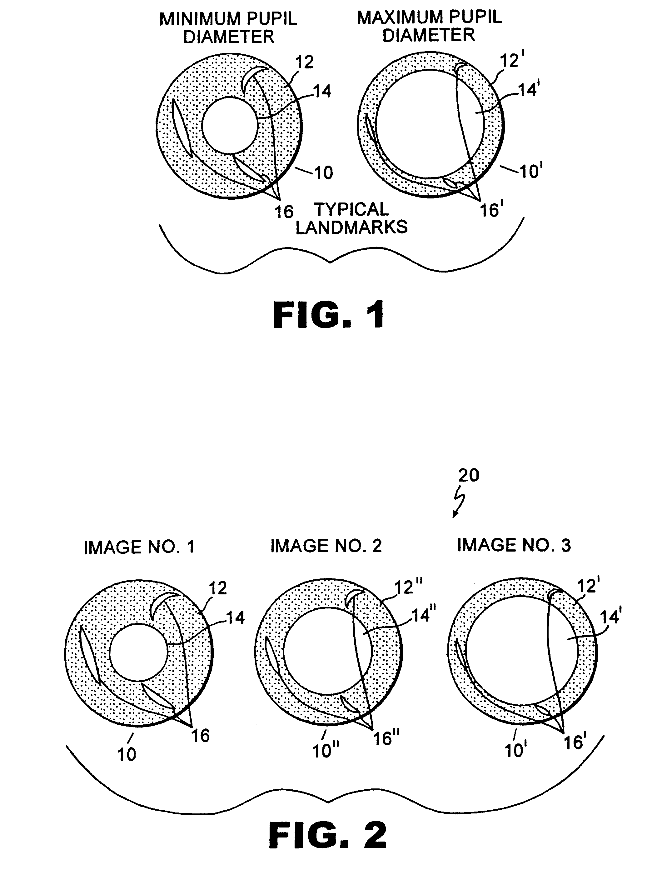 Iris pattern recognition and alignment