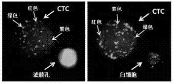 Circulating gastric tumor cell identifying kit
