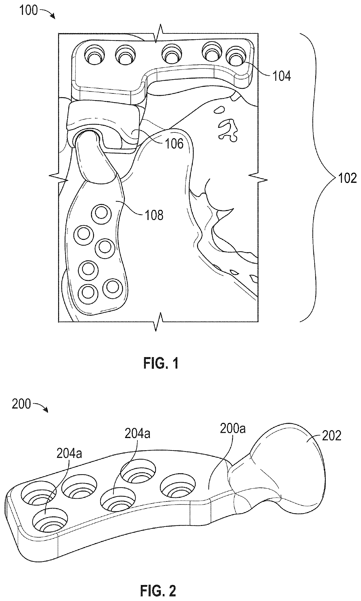 Implantable device for temporomandibular joint and method of production thereof