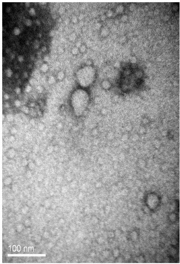 Biological reagent for treating carbapenems resistant acinetobacter baumannii infection