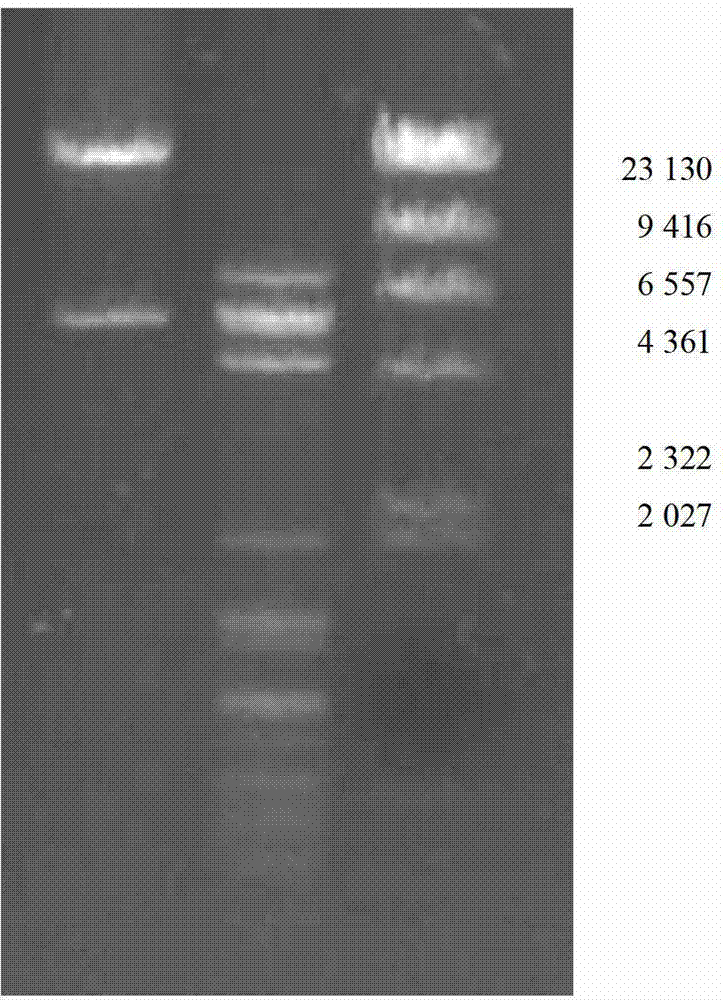 Biological reagent for treating carbapenems resistant acinetobacter baumannii infection