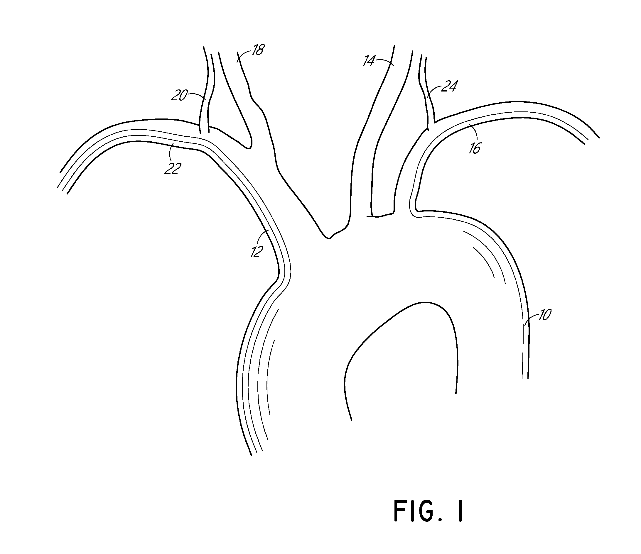 Vascular filters, deflectors, and methods