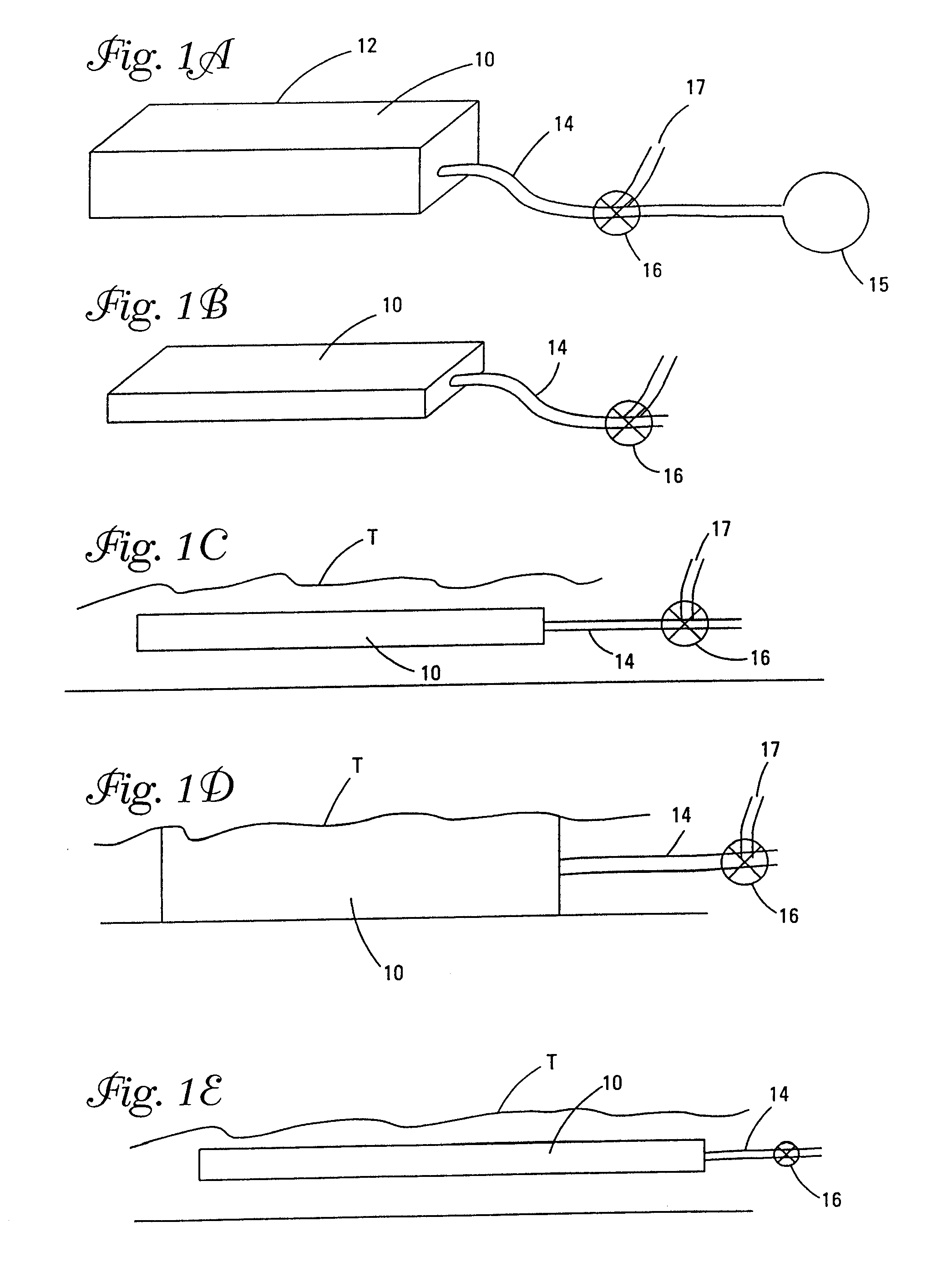 Therapeutic device and system