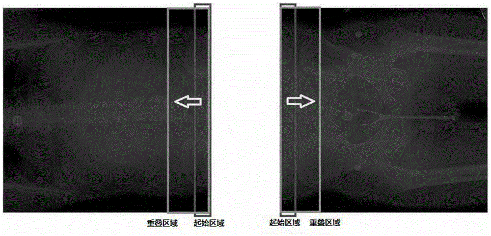 A Medical Image Stitching Method Based on Mutual Information and Interaction