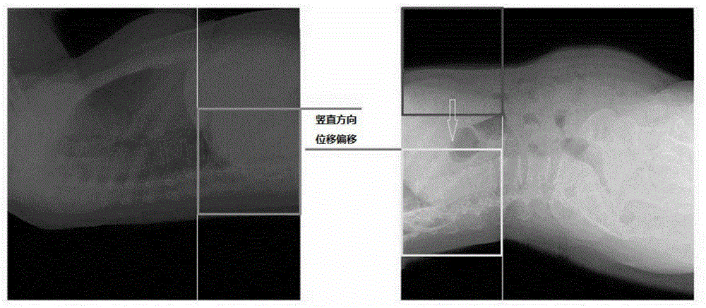 A Medical Image Stitching Method Based on Mutual Information and Interaction