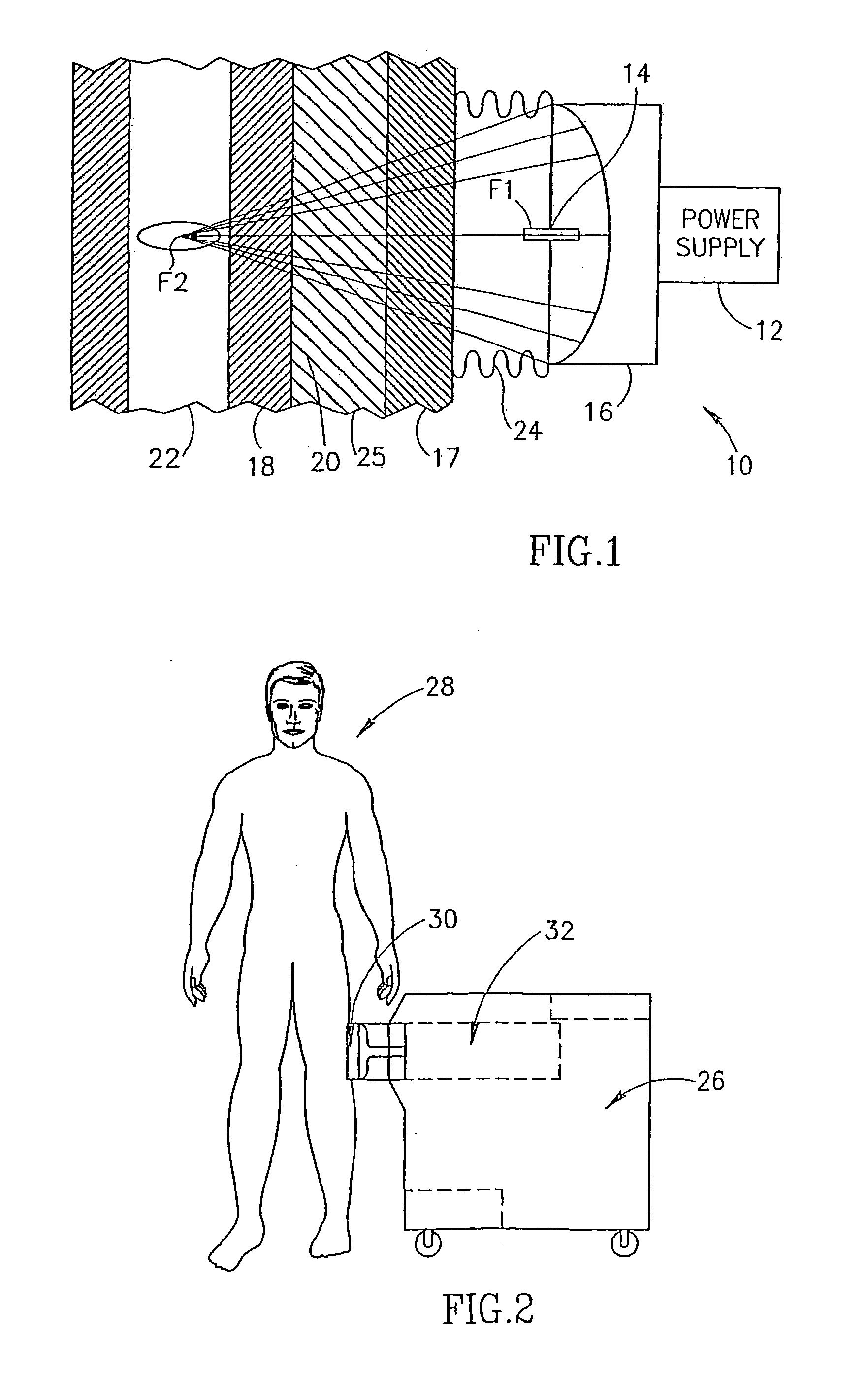 Pressure-pulse therapy device for treatment of deposits