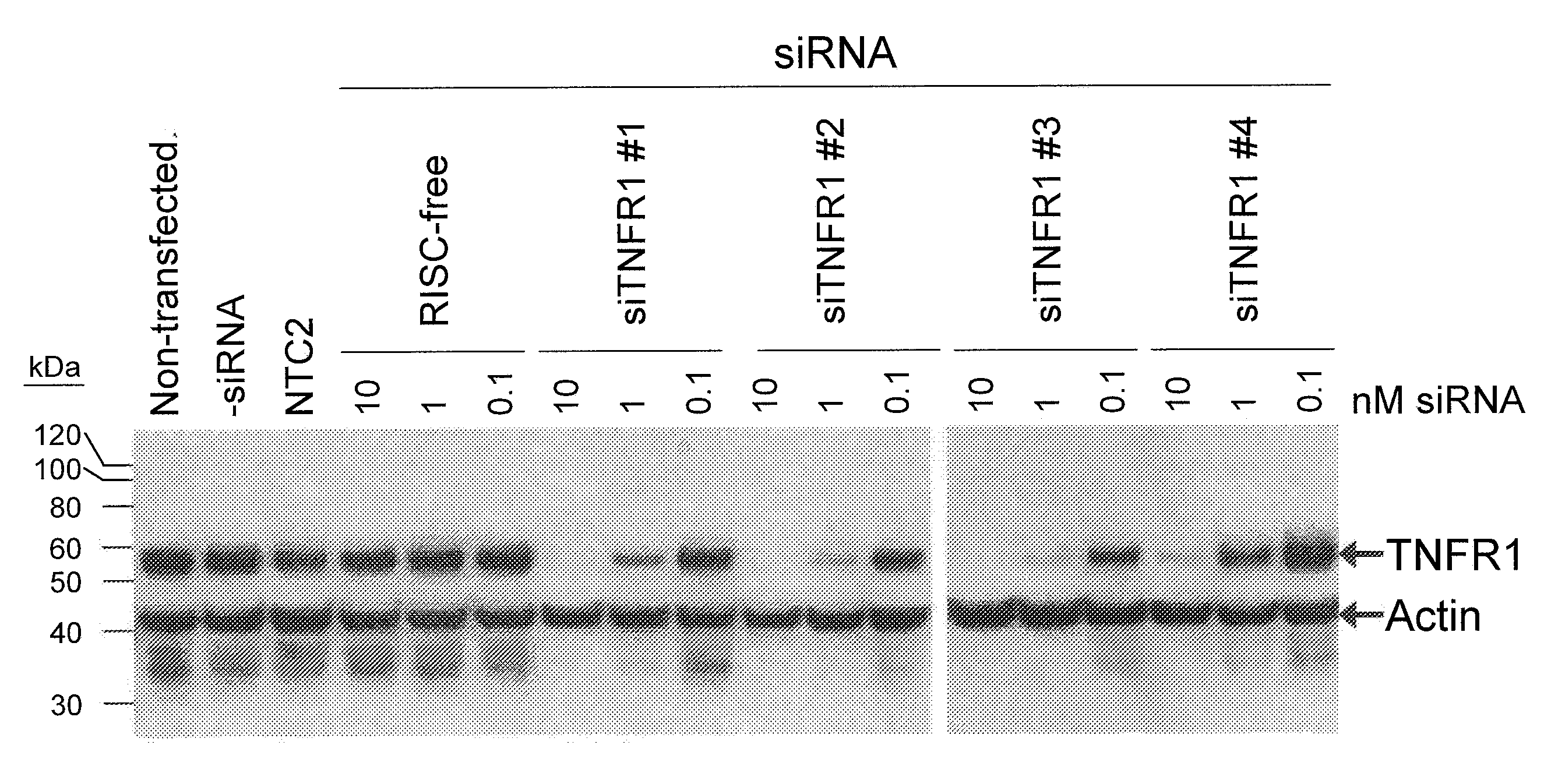 RNAi-RELATED INHIBITION OF TNFa SIGNALING PATHWAY FOR TREATMENT OF GLAUCOMA