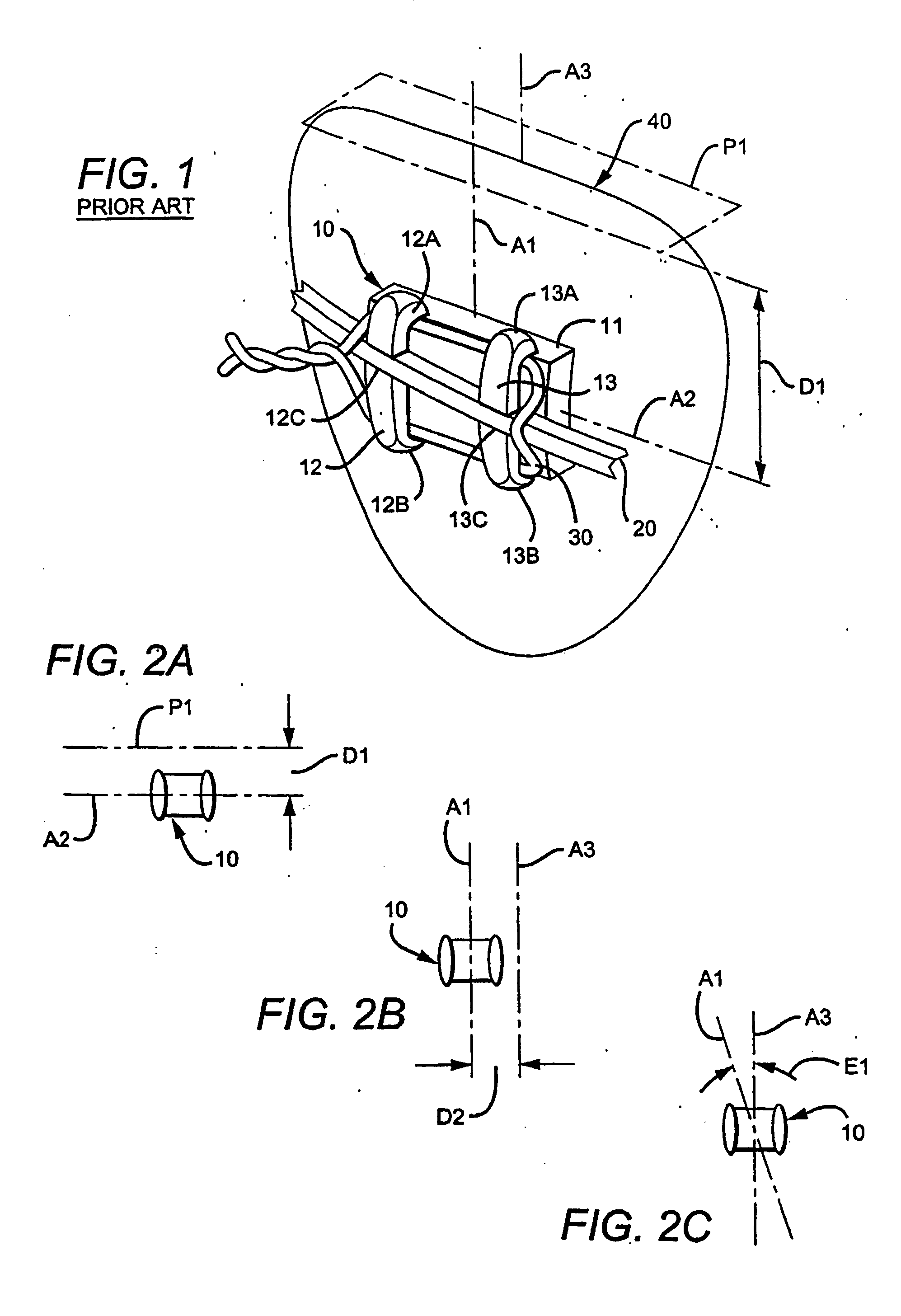 Orthodontic appliances systems methods and tools