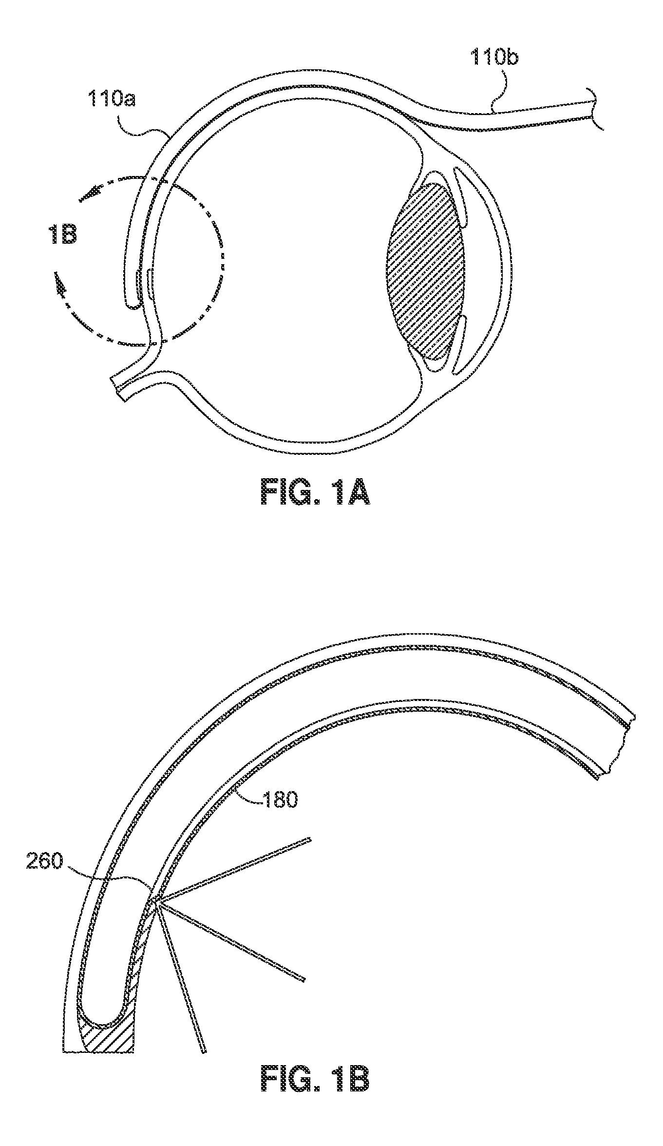 Methods And Devices For Delivering Appropriate Minimally-Invasive Extraocular Radiation